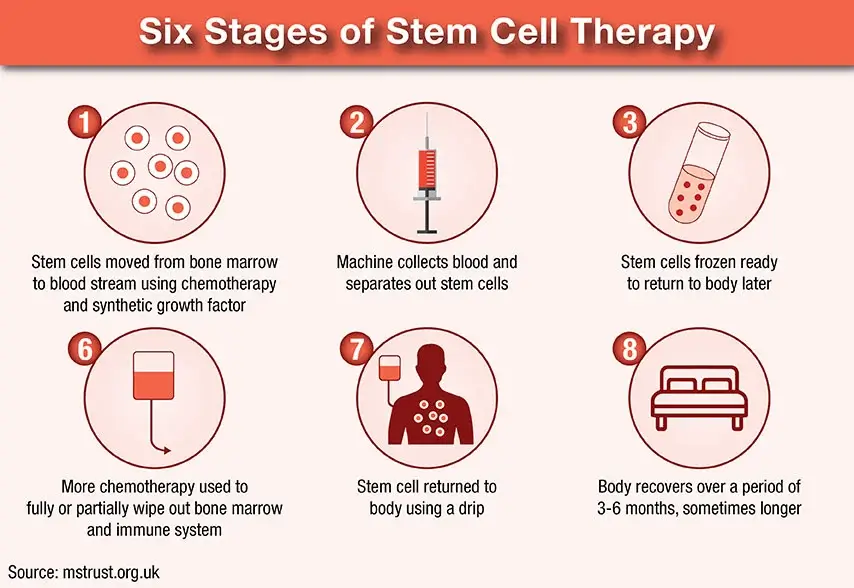 Six stages of stem cell therapy