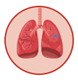 lung cancer
