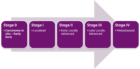 The Different Stages Of Cancer: Explained - Health Blog