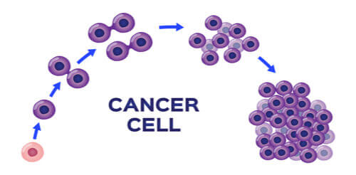 The Different Stages Of Cancer: Explained