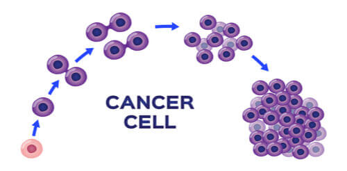 The Different Stages Of Cancer Explained Health Blog